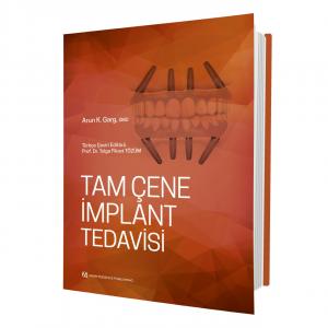 Tam Çene İmplant Tedavisi Prof. Dr. Tolga Fikret Tözüm