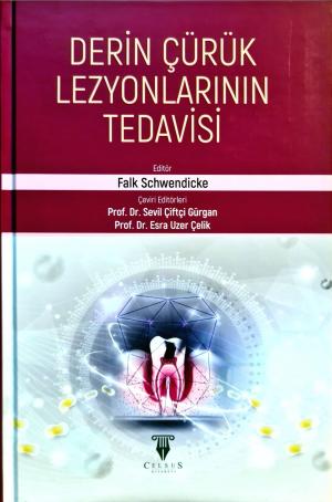 Derin Çürük Lezyonlarının Tedavisi Prof. Dr. Sevil Çiftçi Gürgan